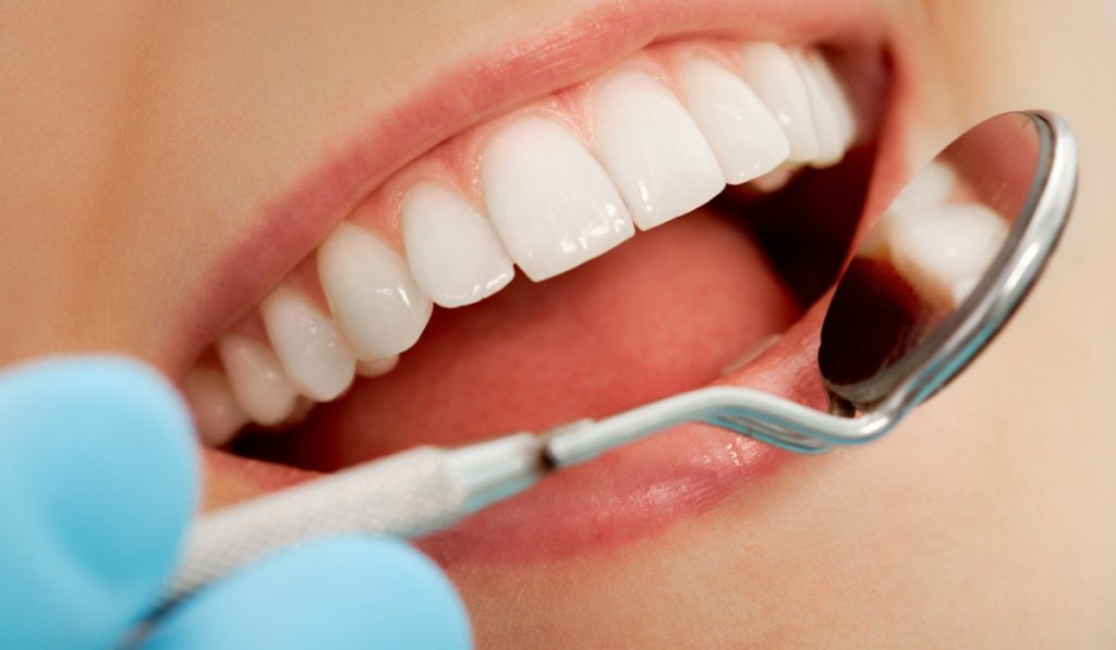 curarsi i denti