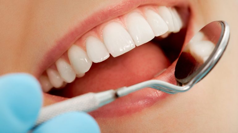 curarsi i denti