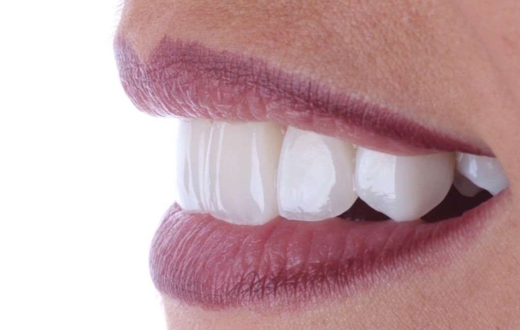 denti fissi in un giorno a Cuneo